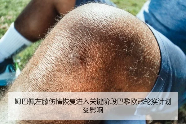 姆巴佩左膝伤情恢复进入关键阶段巴黎欧冠轮换计划受影响